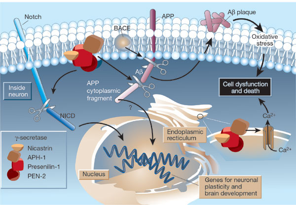 alzheimers treatment