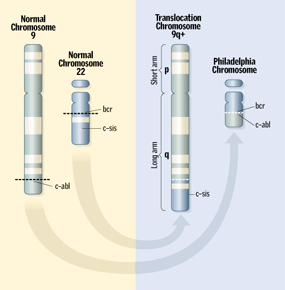 Chromosome Swap in Chronic Myelogenous Leukemia