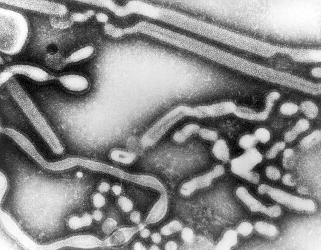 Transmission electron micrograph of influenza A virus, early passage.