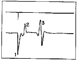 wpe6.jpg (6485 bytes)