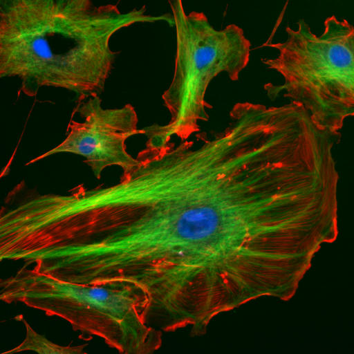 Cytoskeleton